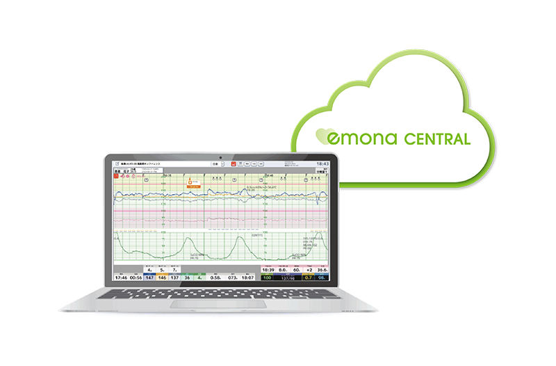 emona CENTRAL（クラウド）